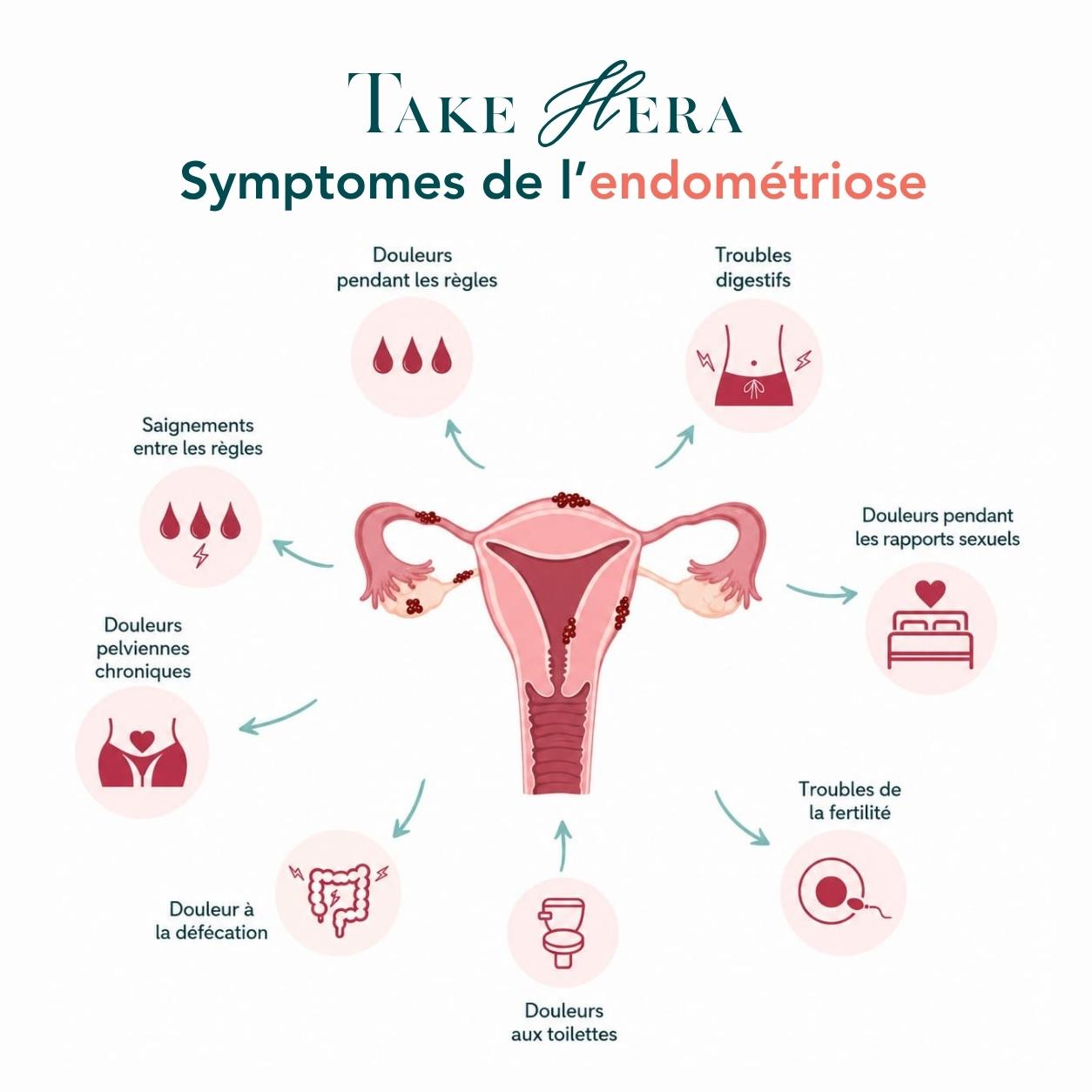 Illustration des symptômes de l'endométriose